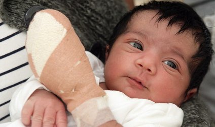 護(hù)士剪臍帶誤剪嬰兒手指 女嬰被緊急送醫(yī)接斷指