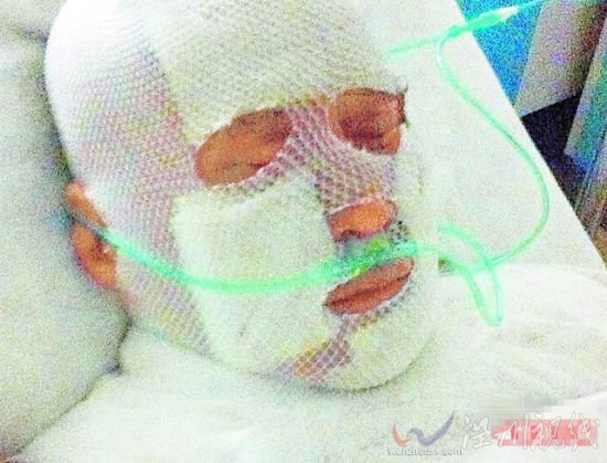 齊秦躺在醫院戴氧氣管。