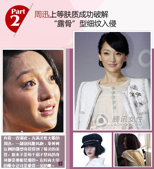 瘦到爆臉遭殃 張柏芝笑顏似骷髏