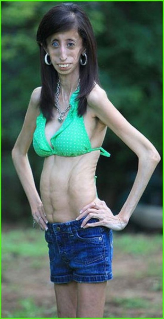 美國零脂肪女孩