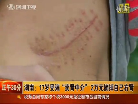 搗毀圈養賣腎者窩點