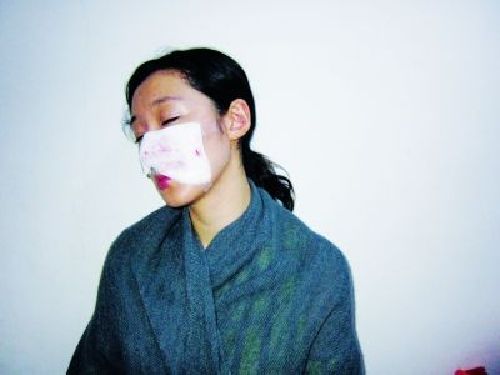 女星藏獒 女星李依馨摸藏獒被咬毀容