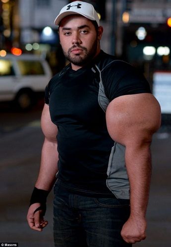 世界最大肱二頭肌