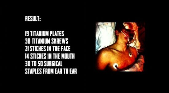 瑞典跑酷高手失誤