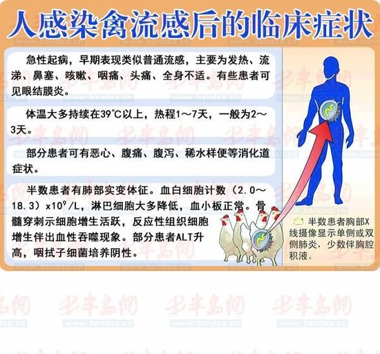 h7n9診療方案