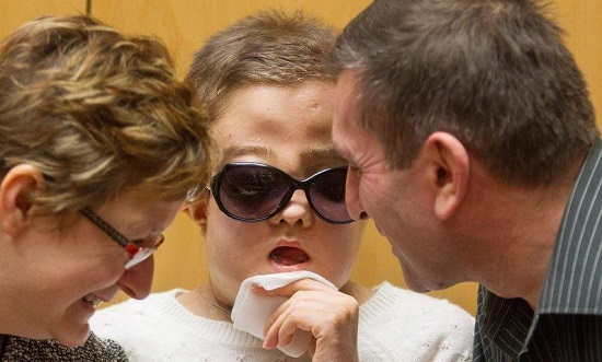 波蘭換臉手術成功案例 26歲女子成功換臉