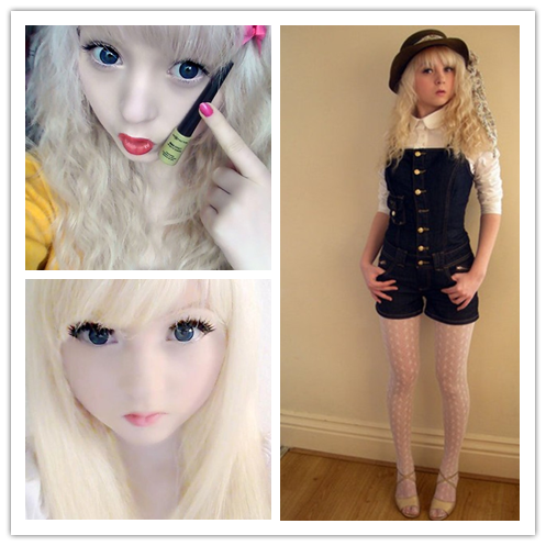 英國白化病女孩