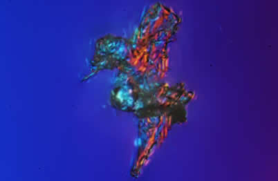 霧霾放大1000倍圖片 顯微