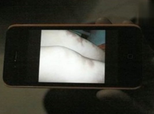 女生墜亡渾身淤青