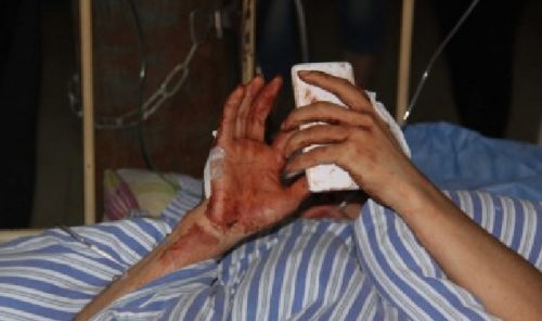 宜春公交車砍人事件：宜春三中柳艷兵奪刀救人受傷無緣高考