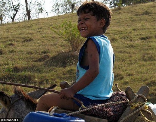 男孩背上長烏龜殼受嘲笑 烏龜殼男孩圖片