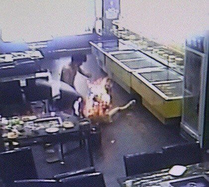 女大學生吃燒烤被燒