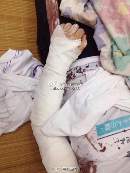 蒼南一中學(xué)女生拿剪刀捅傷同學(xué)