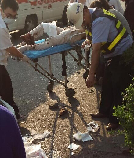 女子穿高跟鞋開車把路邊男子腳掌撞斷