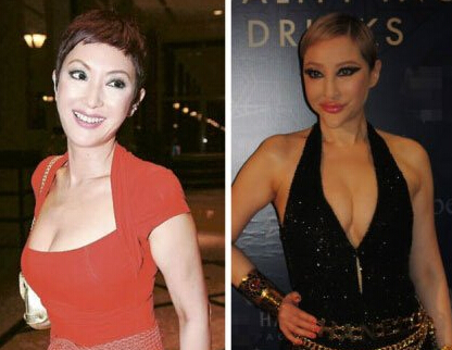 薛芷倫整容前后照片