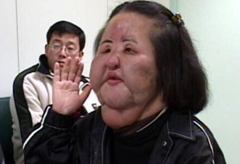 韓國電風扇大媽整容失敗不忍直視