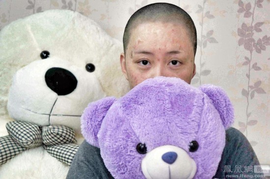 遭官二代毀容少女周巖