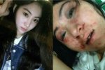 女歌手拒陪酒遭暴打3小時