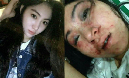 女歌手拒陪酒遭暴打3小時