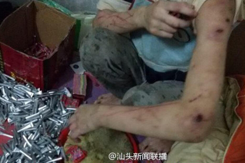 姐弟遭虐打不敢報(bào)警