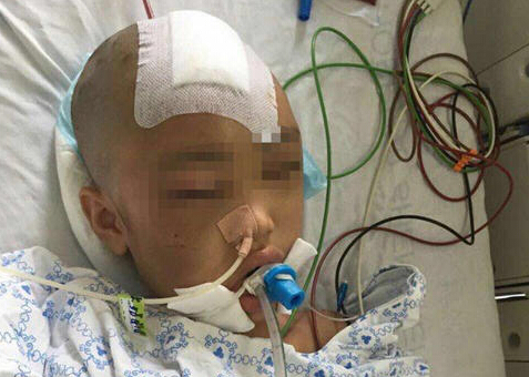 7歲女童偷錢被打重傷