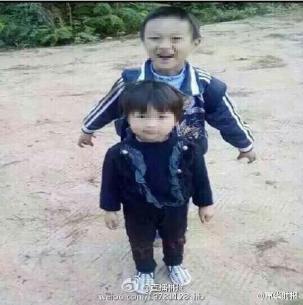 兄妹被人強灌硫酸