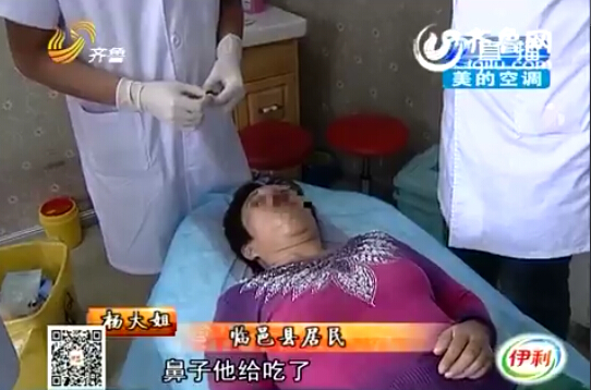 沒接電話鼻子被丈夫咬掉