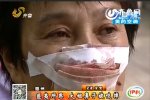 女子沒接電話鼻子被丈夫咬掉