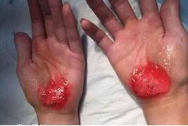 學生被罰用手走路