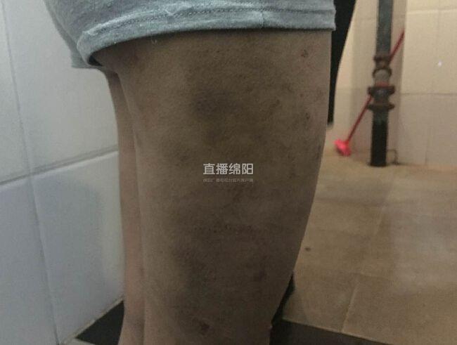 女孩被養(yǎng)父母虐待