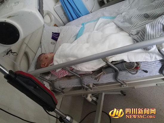 女孩烤火栽進煤爐