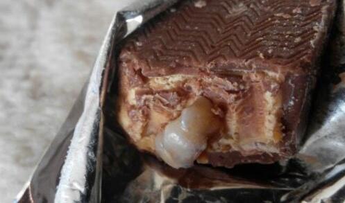 士力架吃出爛牙