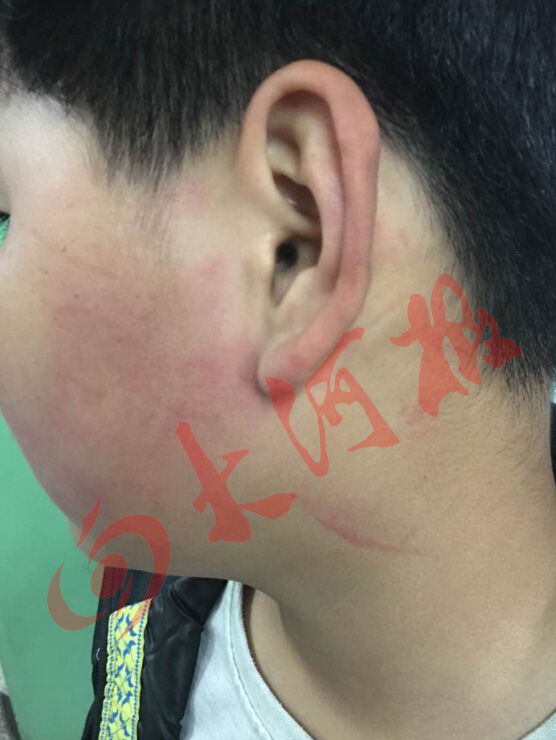 男童撞校長遭暴打