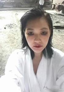 小s滿臉淤青出鏡