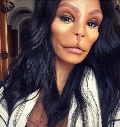 名媛整容成猴臉