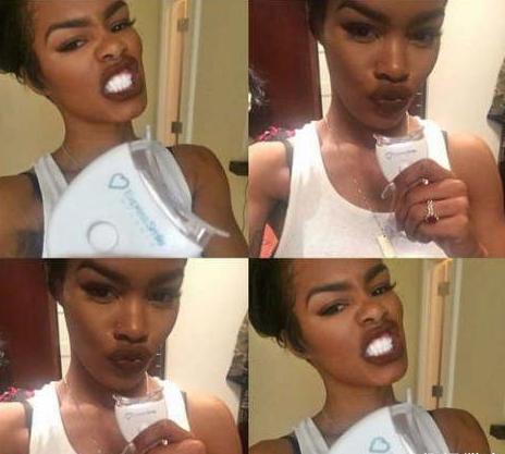 名媛整容成猴臉