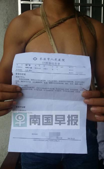 少年遭敲斷鎖骨