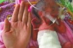 成都女嬰僅巴掌大 早產女嬰生命體征穩定