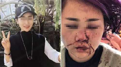 女游客麗江遭毀容