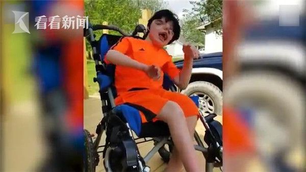 雙臉男孩13歲生日