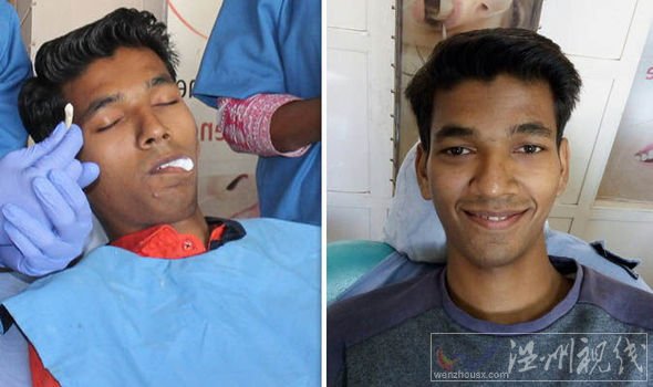 少年牙齒3.67厘米