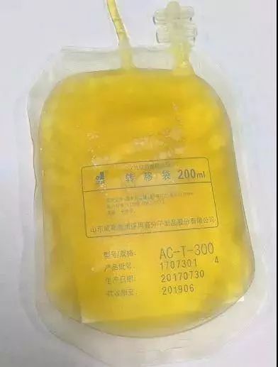 姑娘血漿成豬油色