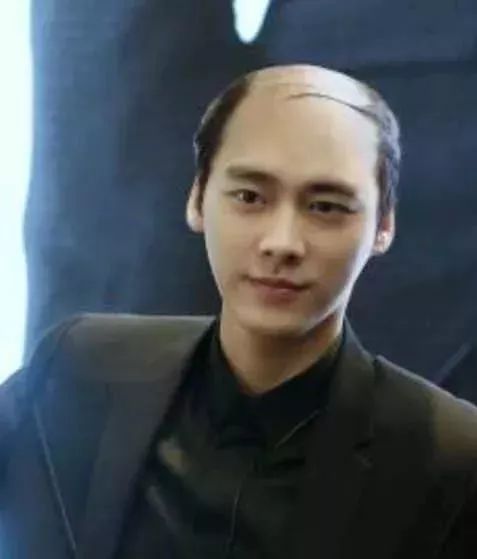 脫發更長壽上熱搜