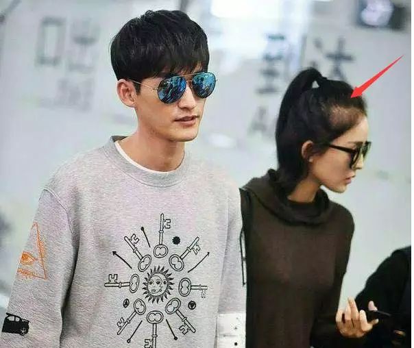 脫發更長壽上熱搜