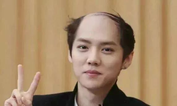 脫發更長壽上熱搜