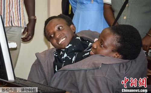 連體嬰姐妹去世