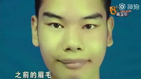 發際線男孩走紅