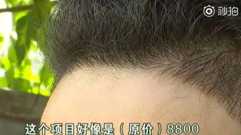 發際線男孩走紅