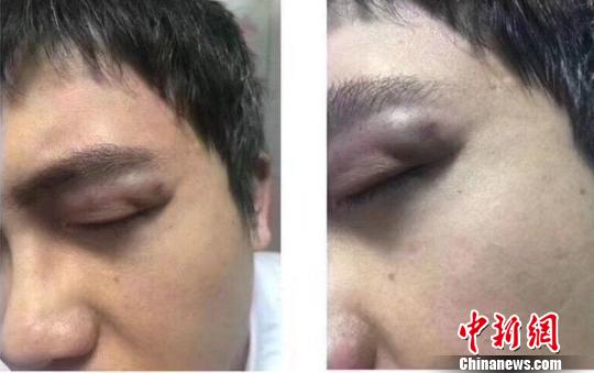 蘭大毆打醫(yī)生被拘