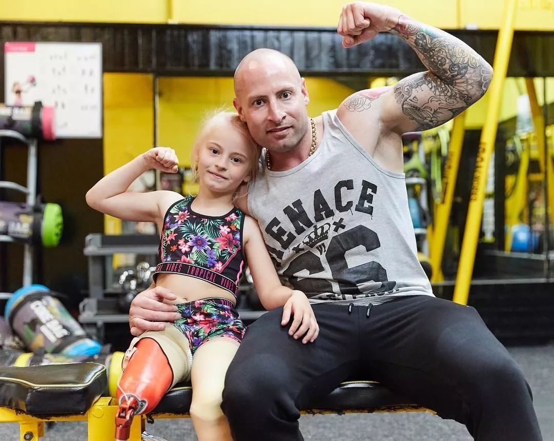 截肢仙女紅遍全球